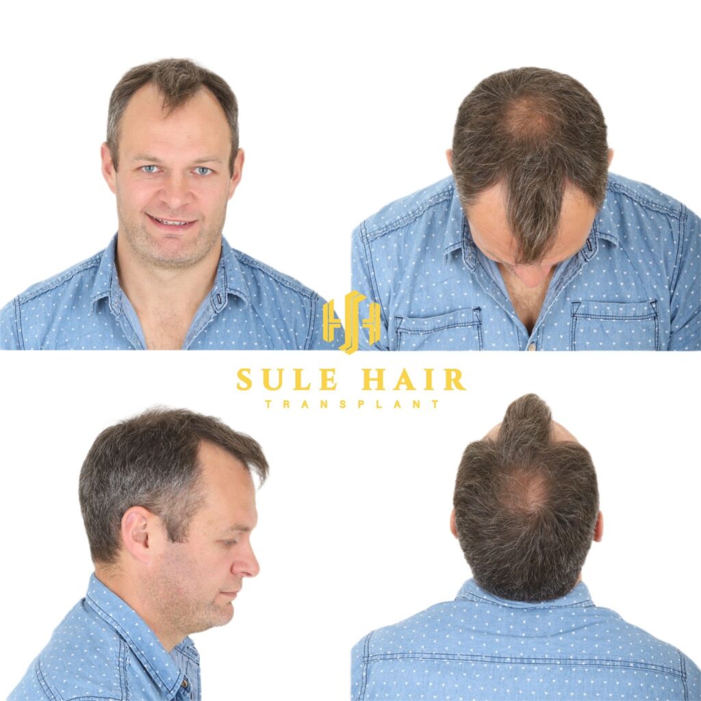 hair consultation sample image