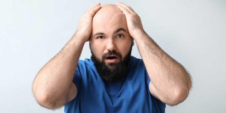 Hair Transplant Failure: Causes, Solutions, and Success Stories