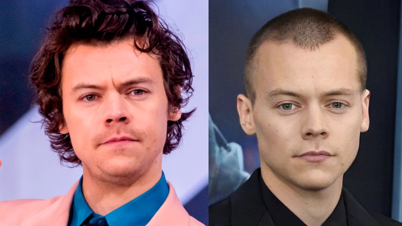 Harry Styles Hair Transplant We Analyzed His Hair SULE HAIR TRANSPLANT