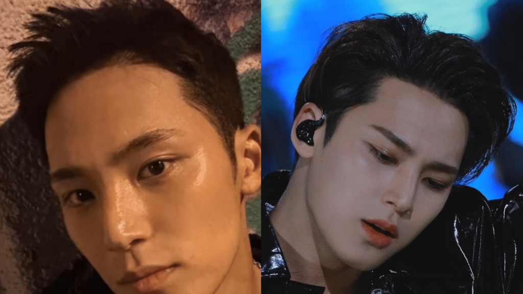 Mingyu hair transplant before after