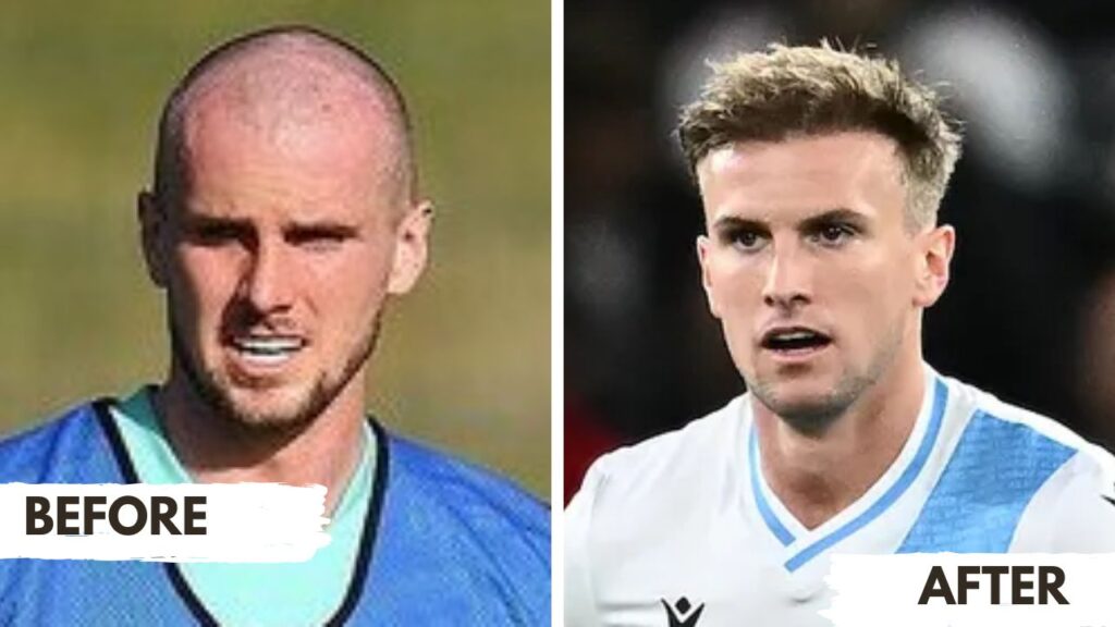 Before and after: Rob Holding's hair