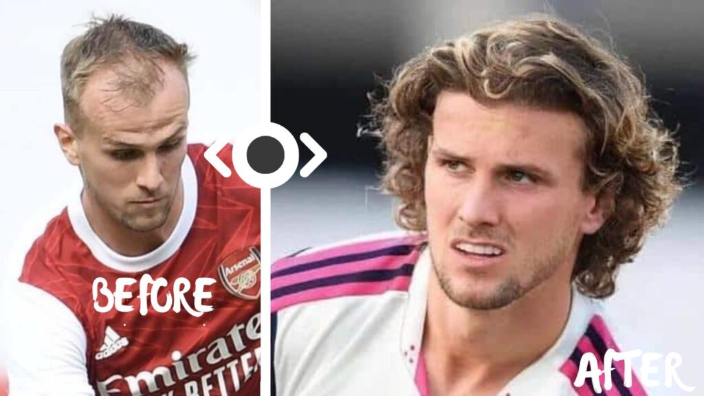 Before and after: Rob Holding's hair transformation