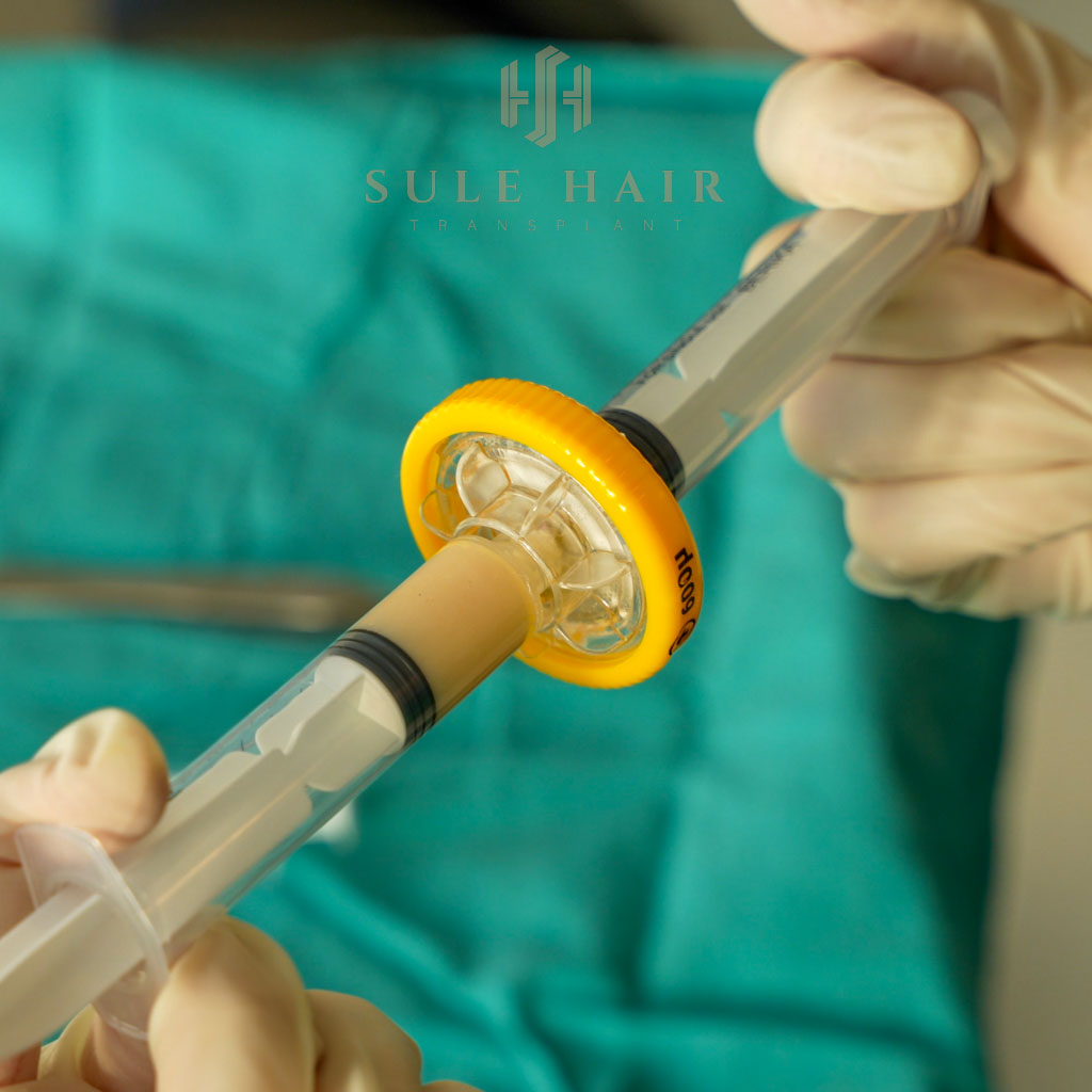 2 Cell Separation during the stem cell treatment