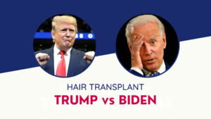 HAIR TRANSPLANT TRUMP vs BIDEN